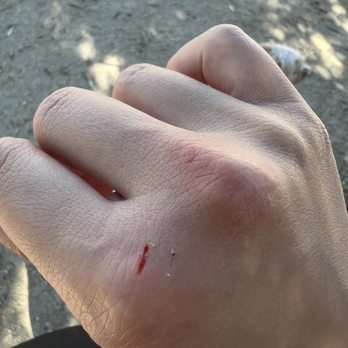 Olive Hills Park - Dog bite - Dog Parks Near Me - Anaheim, California