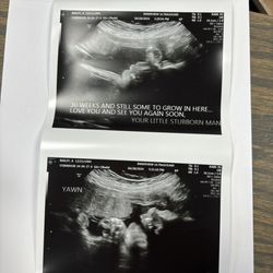 InnerView Ultrasound - Got to see baby today Kelly went above & beyond to get these cute pictures of this stubborn boy! Thank you so much!!