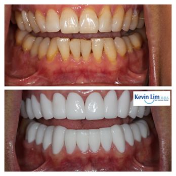 Von Karman Dental - Cosmetic Dentists Near Me - Irvine, California Von Karman Dental - Cosmetic Dentists Near Me - Irvine, California