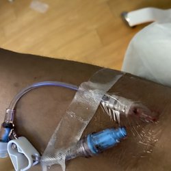 Mary Washington Hospital - 2nd non working blood IV