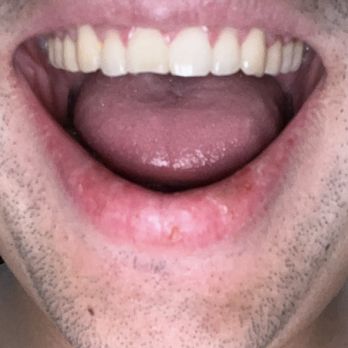 Kai Wu, DDS - Patched up - General Dentistry Near Me - Arcadia, California Kai Wu, DDS - Patched up - General Dentistry Near Me - Arcadia, California