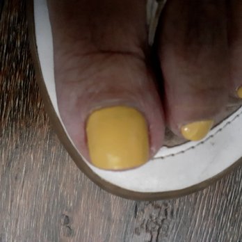 Professionails - Discoloration and swollen nail cuticle on toe - Nail Salons Near Me - Las Vegas, Nevada Professionails - Discoloration and swollen nail cuticle on toe - Nail Salons Near Me - Las Vegas, Nevada