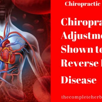 Ash Chiropractic & Acupuncture - Regular chiropractic adjustments go hand in hand with good health. #Chiropractic #Acupuncture #HealthyLife #HolisticHealing #HealthyChoices - Acupuncture Near Me - Carrollton, Texas Ash Chiropractic & Acupuncture - Regular chiropractic adjustments go hand in hand with good health. #Chiropractic #Acupuncture #HealthyLife #HolisticHealing #HealthyChoices - Acupuncture Near Me - Carrollton, Texas