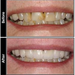 Craig A Segal, DMD - Before and After