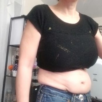Elite Plastic Surgery - year 2022 Literally none of my clothes fits. - Cosmetic Surgeons Near Me - Phoenix, Arizona Elite Plastic Surgery - year 2022 Literally none of my clothes fits. - Cosmetic Surgeons Near Me - Phoenix, Arizona