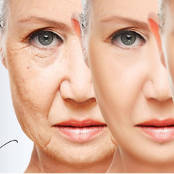 Marlene Granados - The HIFU system is a modern technology that is outlined as the most efficient medical aesthetic application for skin tightening