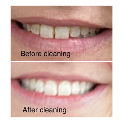 Murphy's Landing Family Dental