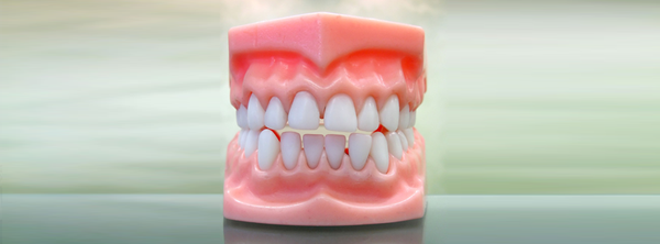 denture 様　NEIGHBORHOOD Expert Dentures Kent, WA - Toulus Dentures & Implants Center