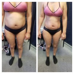 Total Image Master Body Sculpting