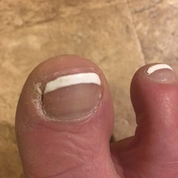 This was their pedicure when I left the salon. Never again will I go back. This was their pedicure when I left the salon. Never again will I go back.