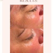 SKIN CARE BY AQ - Updated February 2025 - 36 Photos & 19 Reviews ...