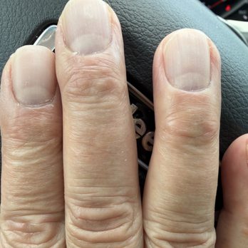The Nailtural - Middle finger- cuticle still visible Ring finger - sharp/pointy outer nail - Nail Salons Near Me - Temecula, California The Nailtural - Middle finger- cuticle still visible Ring finger - sharp/pointy outer nail - Nail Salons Near Me - Temecula, California