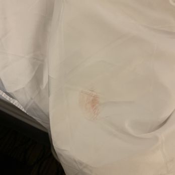 Holiday Inn Clark - Newark Area - This should be thrown away. Disgusting - Hotels Near Me - Clark, New Jersey Holiday Inn Clark - Newark Area - This should be thrown away. Disgusting - Hotels Near Me - Clark, New Jersey