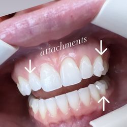 RISUS Orthodontics