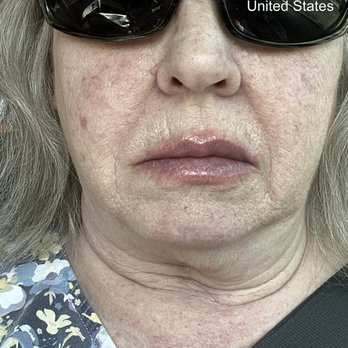 Ideal Dental Cibolo - Swollen face - General Dentistry Near Me - Cibolo, Texas