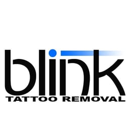 Blink Tattoo Removal