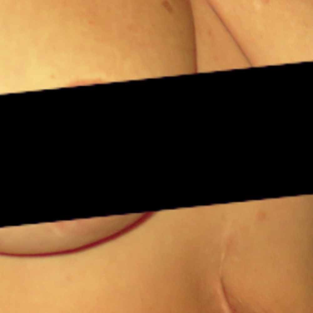Sean Lille, MD - After - looks natural; couldn't be happier. - Plastic Surgeons Near Me - Scottsdale, Arizona