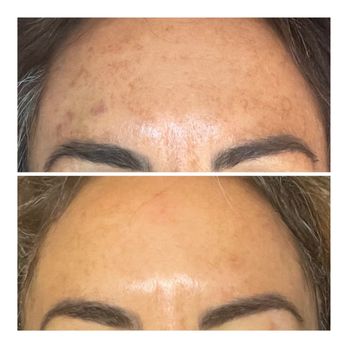 Ali Cat's Spa - Photo Facial - Skin Care Near Me - Mesa, Arizona Ali Cat's Spa - Photo Facial - Skin Care Near Me - Mesa, Arizona