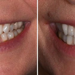 AH Smiles: Brent A. Engelberg