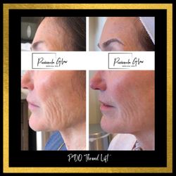 Peninsula Glow Medical Spa