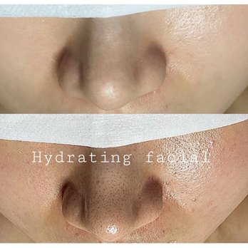 Jin Aesthetics - Skin Care Near Me - Dublin, California Jin Aesthetics - Skin Care Near Me - Dublin, California