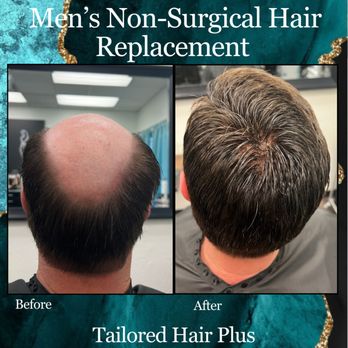 Tailored Hair Plus - Hair Loss Centers Near Me - Phoenix, Arizona Tailored Hair Plus - Hair Loss Centers Near Me - Phoenix, Arizona
