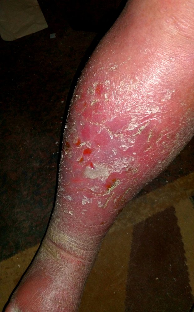 Professional Home Health Care - home care agency in Santa Fe, NM