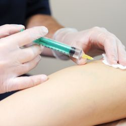 Physicians Vein Clinics - Sclerotherapy