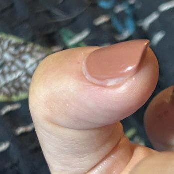 Miya Nails and Spa - ..and it's not just one nail. 6/10 nails look this way. - Nail Salons Near Me - Tuckahoe, Virginia Miya Nails and Spa - ..and it's not just one nail. 6/10 nails look this way. - Nail Salons Near Me - Tuckahoe, Virginia