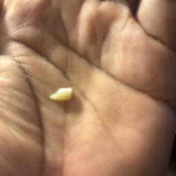 The piece of tooth that broke off The piece of tooth that broke off