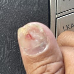 Swedesboro Nail Spa - I was shaking from the pain, trying to get a photo. He tore up my fingernail.