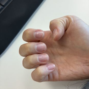 2EM Nail Place - Damage - Nail Salons Near Me - Irvine, California