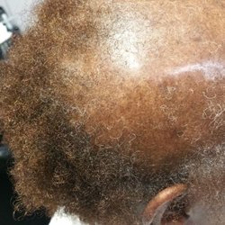 Before Treatment