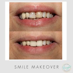 Bright Inspired Dentistry