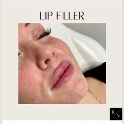 Vadara Med Spa - We offer Botox, Filler, Lip Filler, PDO Threads, PRP, Kybella, Juvederm, etc