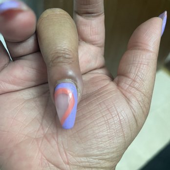 Cali Nails & Spa - A bad nail infection. - Nail Salons Near Me - Berkeley, California