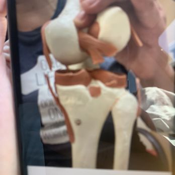 Davis Law Firm - This is my wife's knee, cap and leg. It's totally detached - Bankruptcy Law Near Me - San Antonio, Texas Davis Law Firm - This is my wife's knee, cap and leg. It's totally detached - Bankruptcy Law Near Me - San Antonio, Texas