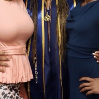 Imagine Plastic Surgery Center - Left picture, 7 months post op - Cosmetic Surgeons Near Me - Riverside, California