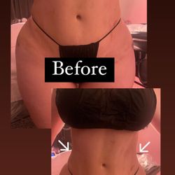 Bodiesbyyazmin - Post-op care