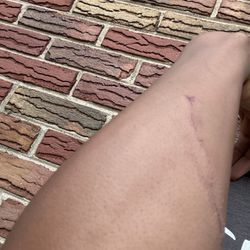 Krave - I went back in krave and one of the bar tenders attacked. This cut is from a knife he had.