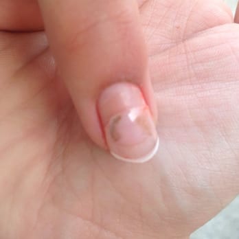Cali Nails - Pre nail removal - Nail Salons Near Me - Fort Wayne, Indiana