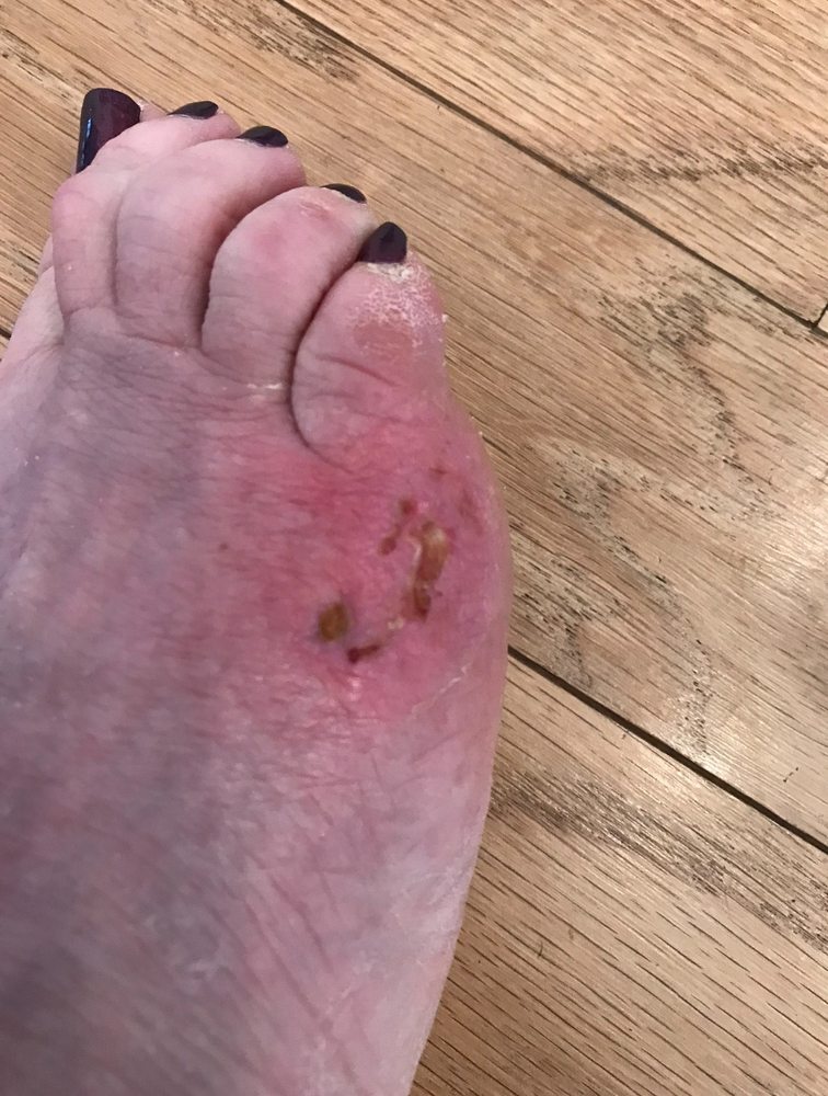 Ryan Shock , DPM - patient advocate in Austin, TX