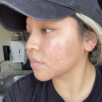 Skin By Britney - Skin Care Near Me - Cypress, California Skin By Britney - Skin Care Near Me - Cypress, California