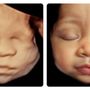 Photo of Baby Moon