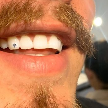 Tooth Gems By Grac13lla - Swarovski crystal - Cosmetic Dentists Near Me - Los Angeles, California Tooth Gems By Grac13lla - Swarovski crystal - Cosmetic Dentists Near Me - Los Angeles, California