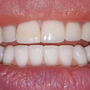 Gary Osmanoff, DDS