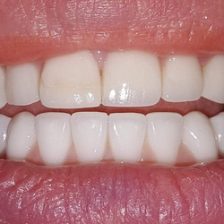 Gary Osmanoff, DDS