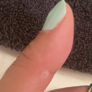 Stylish Nails - Residue from my nails on my hand that she tried to scrub off with a nail file and a large lump in the center of my thumb. - Nail Salons Near Me - Highland, California Stylish Nails - Residue from my nails on my hand that she tried to scrub off with a nail file and a large lump in the center of my thumb. - Nail Salons Near Me - Highland, California
