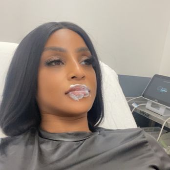 LaserAway - Numbing lips waiting on Tay to do me:) - Medical Spas Near Me - Atlanta, Georgia LaserAway - Numbing lips waiting on Tay to do me:) - Medical Spas Near Me - Atlanta, Georgia