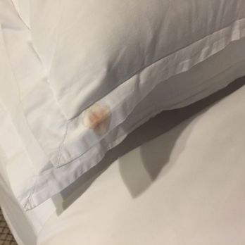 Sheraton Ambassador Hotel - Stains on pillow. I think it's blood - Hotels Near Me - Monterrey, NLE Sheraton Ambassador Hotel - Stains on pillow. I think it's blood - Hotels Near Me - Monterrey, NLE